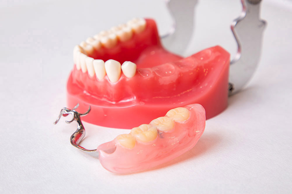 入れ歯とは