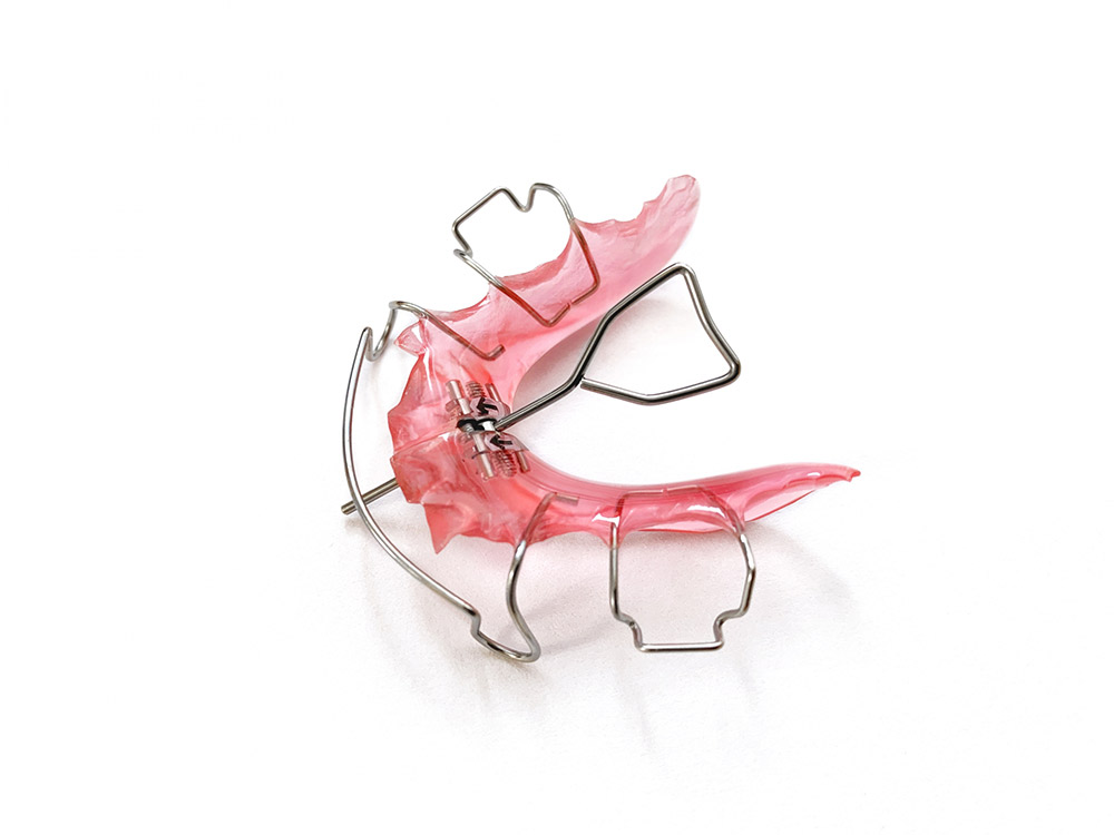 動的治療の終了 保定の開始